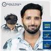 wasim-hongekar-2500-grafts-i-fue-hair-transplant-9-month-result-pune.jpg-82kb.jpg
