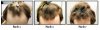 Receding-Hairline-Before-After-x-311.jpg