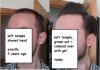 left side combed over.jpg
