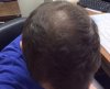 hairloss1.jpg