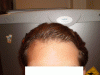 Hairline 060109.GIF
