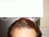 Hairline.GIF