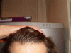 Hairline 20100227.gif
