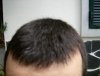 hairline web.JPG