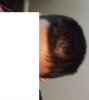 Front of Head 3 Sept 27 2015.jpg Front of Head 3 Sept 27 2015.jpg