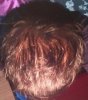 hair loss 2.jpg