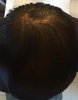hair loss 1.jpg
