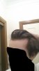 hairloss3.jpg