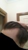 hairloss4.jpg