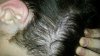 Other part of scalp that is not affected.jpg