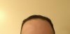 forehead far.jpg