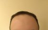 forehead close.jpg