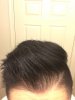 hairline 3.JPG hairline 3.JPG