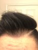 hairline close up.JPG hairline close up.JPG