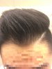 hairline.JPG hairline.JPG
