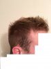 SIDEOFHEAD1.jpg SIDEOFHEAD1.jpg
