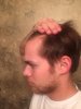balding...jpg