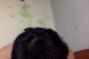 Hair loss concer.jpg