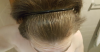 hairline now.png