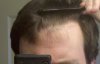 hairline_1.jpg