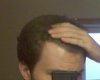 hairline_2.jpg