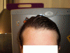 Hairline 15052010.GIF