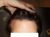 Hairline Dry 15052010.GIF