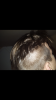 Hair whorl, back of my head.png