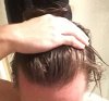 hairloss4wet.jpg