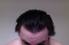 Frontal hair 2017-02-12.jpg
