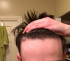 hairline.png