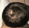 hairlosstalk3.jpg