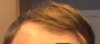 AH hairline 1.jpg