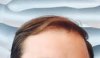 AH hairline 2.jpg