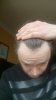 Hairline3.JPG