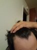 hair loss 3.jpg