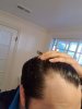 hair loss 4.jpg