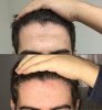 hairlines.jpg