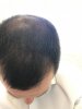 hairline.jpg