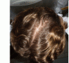 Crown - Dry Hair 25082010.gif