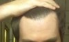 hairline.jpg