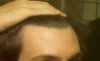 hairline2.jpg