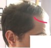 hairline2.jpg