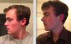 Hair comparisons 1 year.png