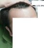 hairline1.jpg