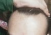 hairline2.jpg