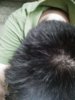 hairline4.jpg