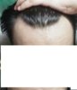hairline5.jpg