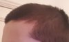 hairline2.jpg