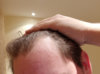 Receding.jpg Receding.jpg